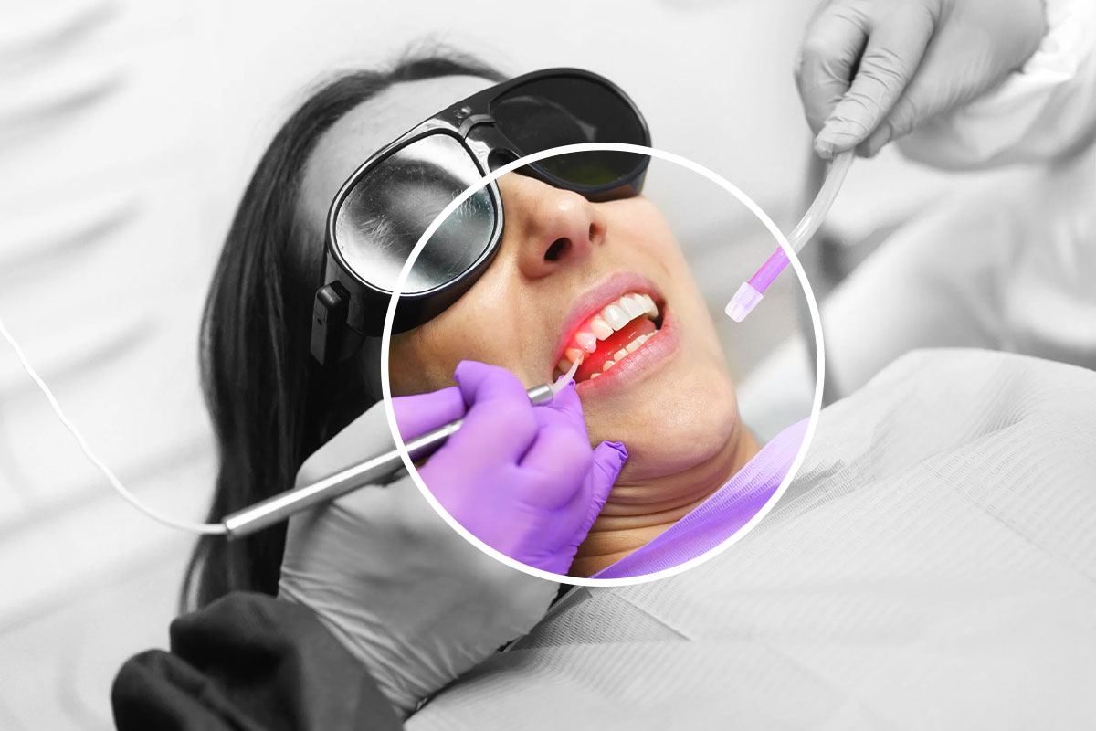 Tratamente dentare cu laser Alor